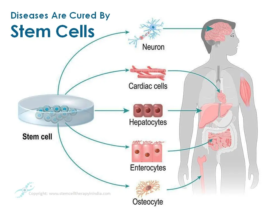 Conditions Treated via Stem Cells