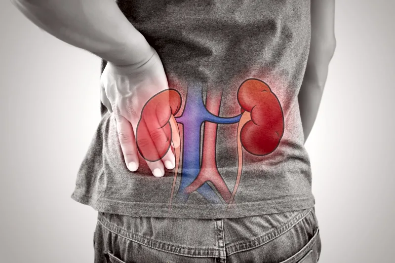 Stem Cell Therapy for Kidney