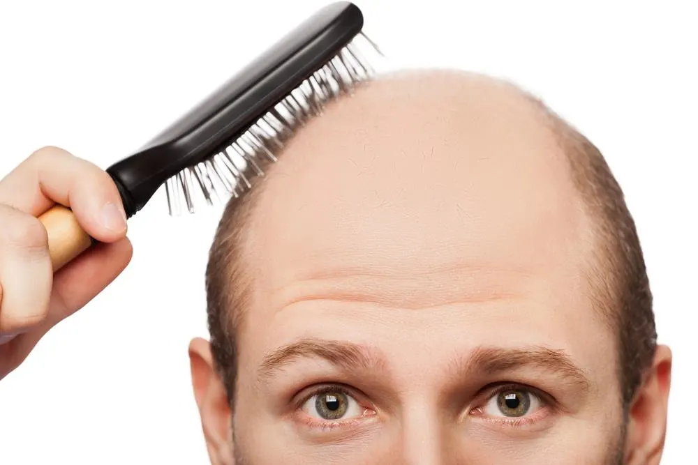 العلاج بالخلايا الجذعية لتساقط الشعر